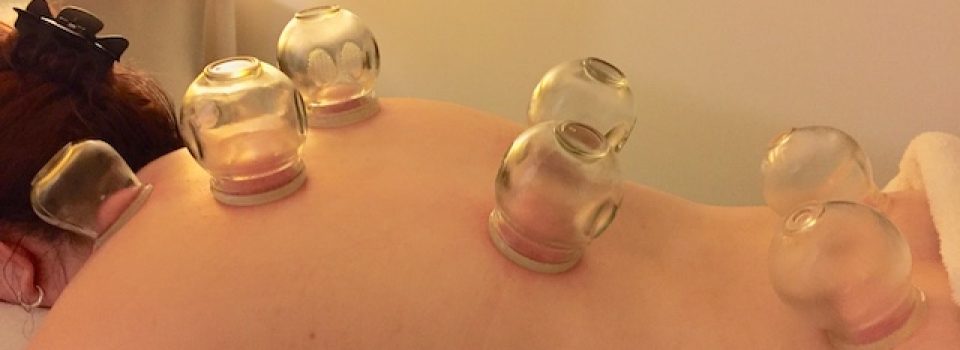 Cupping at Shine Health Wellbeing Centre
